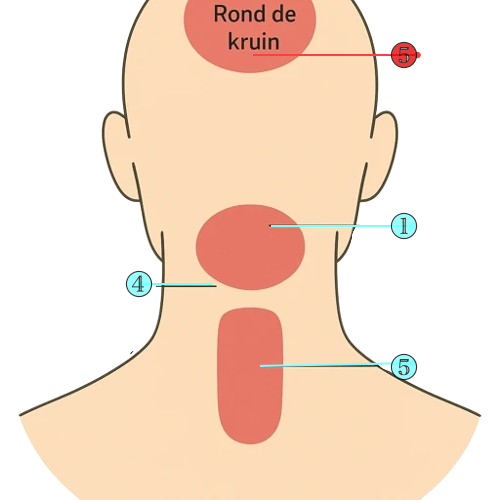 Achterhoofd met pijnplekken