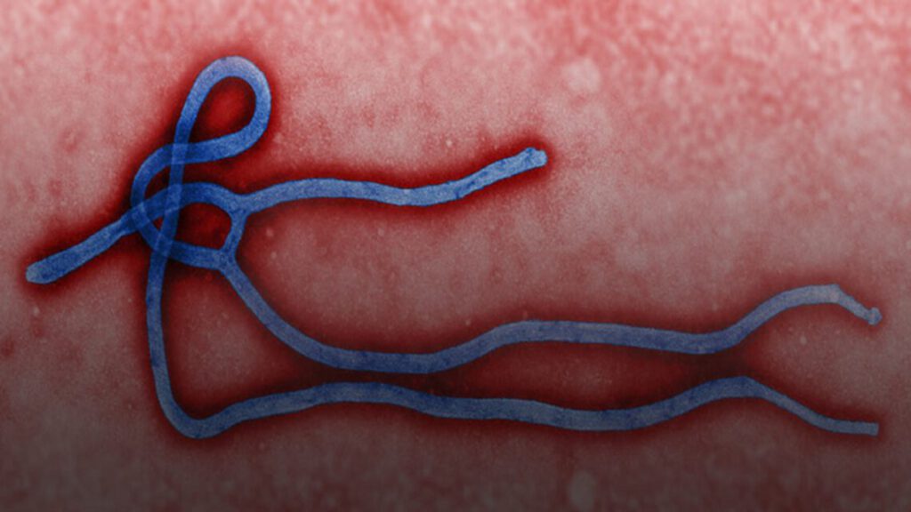Ebola virus microscopisch beeld